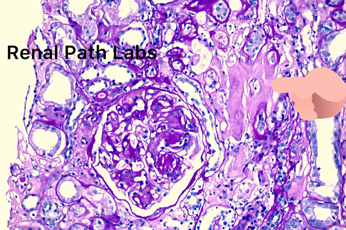 Renal Path Labs tweet media