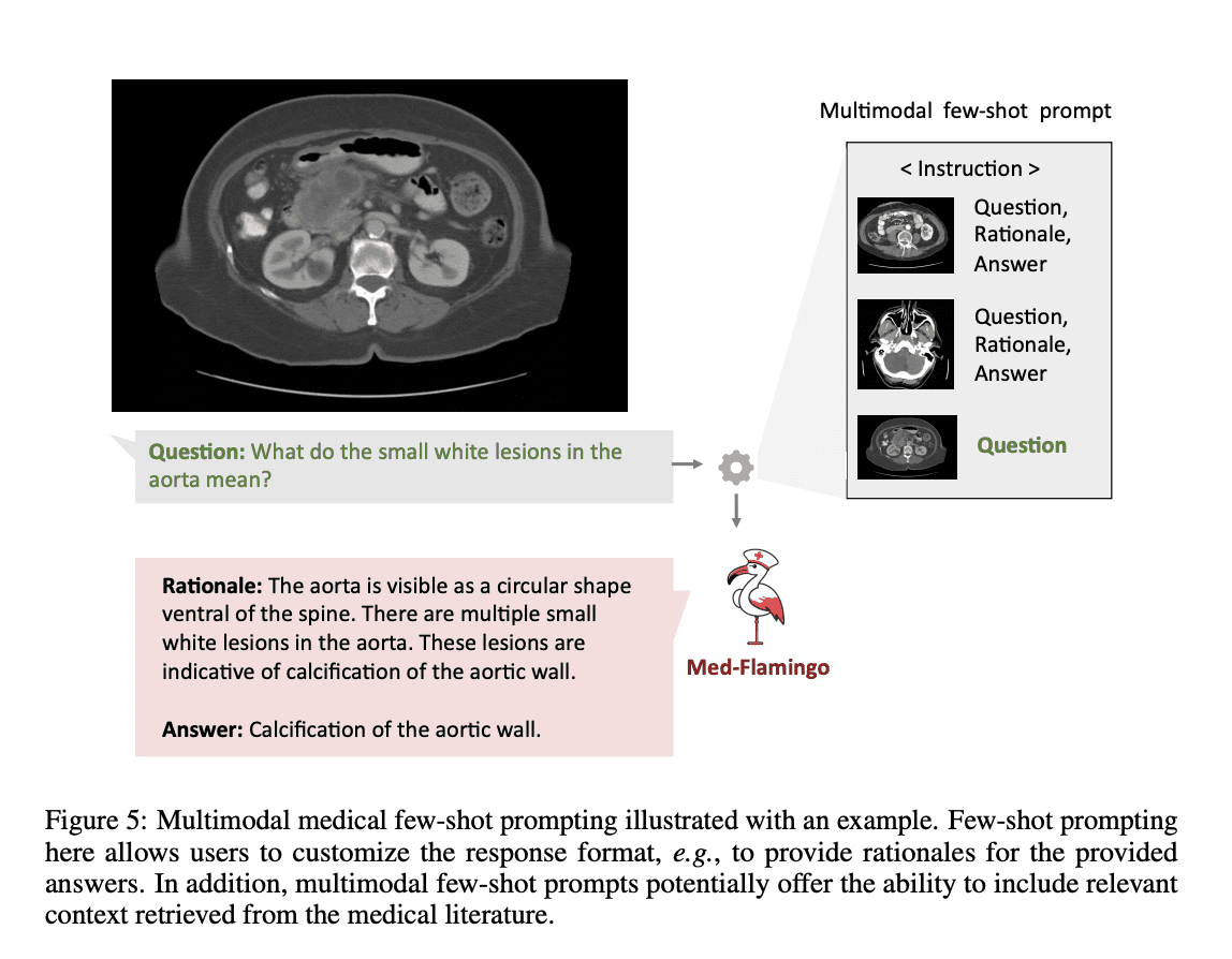 MultiplatformAI's tweet image. Med-Flamingo: Advancing Medical AI with Multimodal In-Context Learning

#AI #artificialintelligence #foundationmodel #generativeVQAtasks #Healthcare #incontextlearning #llm #machinelearning #MedFlamingo #medicalreasoning #multimodalknowledge

multiplatform.ai/med-flamingo-a…