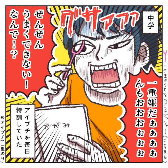 10年前に美容整形した話(1/3)再掲