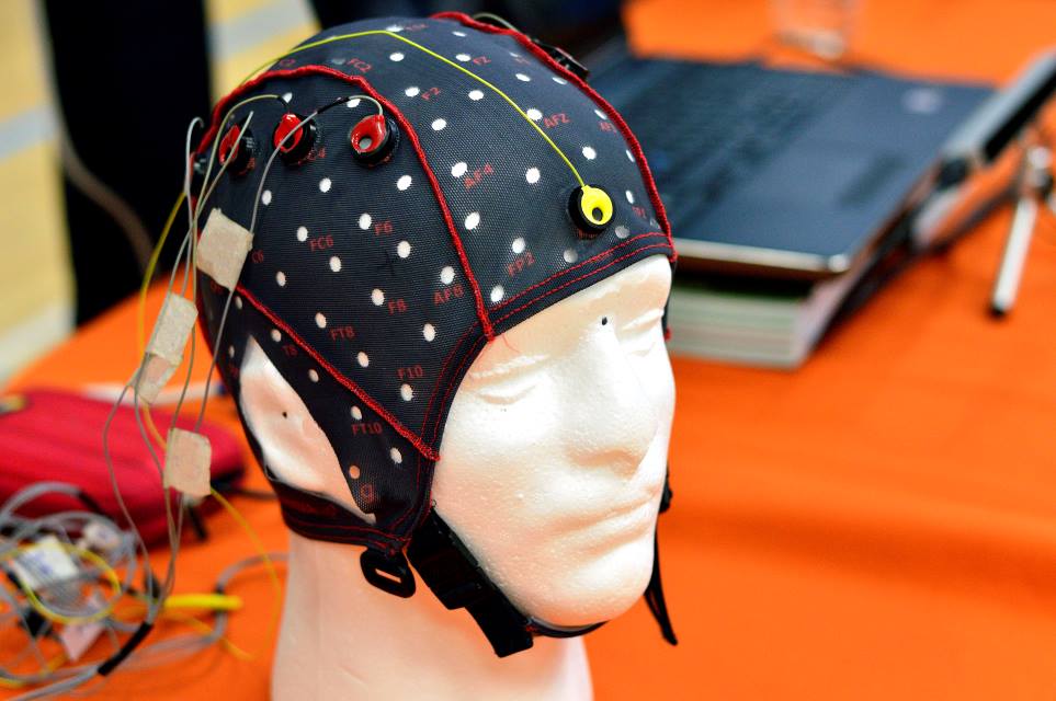 Neurology Today (@neurologytoday) on Twitter photo Via <a href="/JAMANeuro/">JAMA Neurology</a>: An #ArtificialIntelligence program interprets EEGs as accurately as experts, not only distinguishing normal from abnormal EEGs but also identifying the type of abnormalities: bit.ly/43SvThY
#NeuroTwitter #AI #neurotech <a href="/AANMember/">American Academy of Neurology</a> <a href="/SBeniczky/">Sandor Beniczky</a> <a href="/UCSFepilepsy/">UCSFepilepsy</a> Via <a href="/JAMANeuro/">JAMA Neurology</a>: An #ArtificialIntelligence program interprets EEGs as accurately as experts, not only distinguishing normal from abnormal EEGs but also identifying the type of abnormalities: bit.ly/43SvThY
#NeuroTwitter #AI #neurotech <a href="/AANMember/">American Academy of Neurology</a> <a href="/SBeniczky/">Sandor Beniczky</a> <a href="/UCSFepilepsy/">UCSFepilepsy</a>