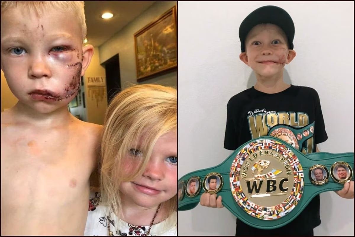 trad_west_'s tweet photo. Six-year-old Bridger Walker is a real-life superhero!
The boy protected his little sister from an aggressive dog that injured him during the daring rescue—Bridger had to get 90 stitches for his wounds.
“If someone was going to die, I thought it should be me,” the boy said. https://t.co/L2mq0jVMfF