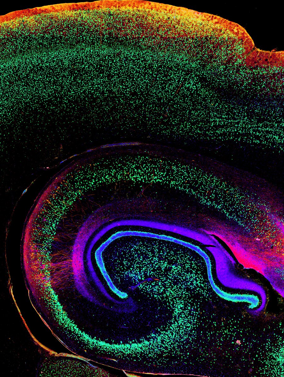 #FluorescenceFriday is the best day for some hippocampus photos!🔬 🤓Markers: 🔴Tau pS422, 🔵 AT8, 🟢NeuN #neuroscience <a href="/zeiss_micro/">ZEISS Microscopy</a>