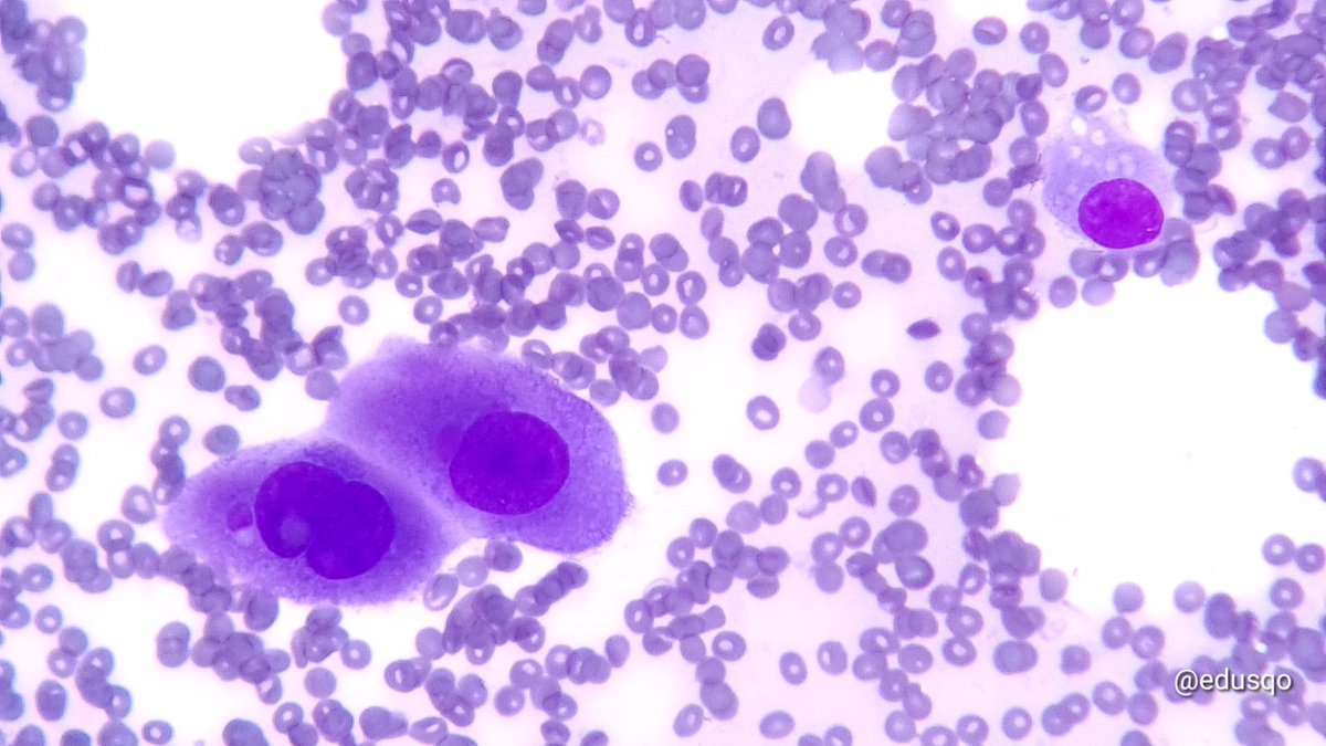 Eduardo Alcaraz, MD PhD tweet media