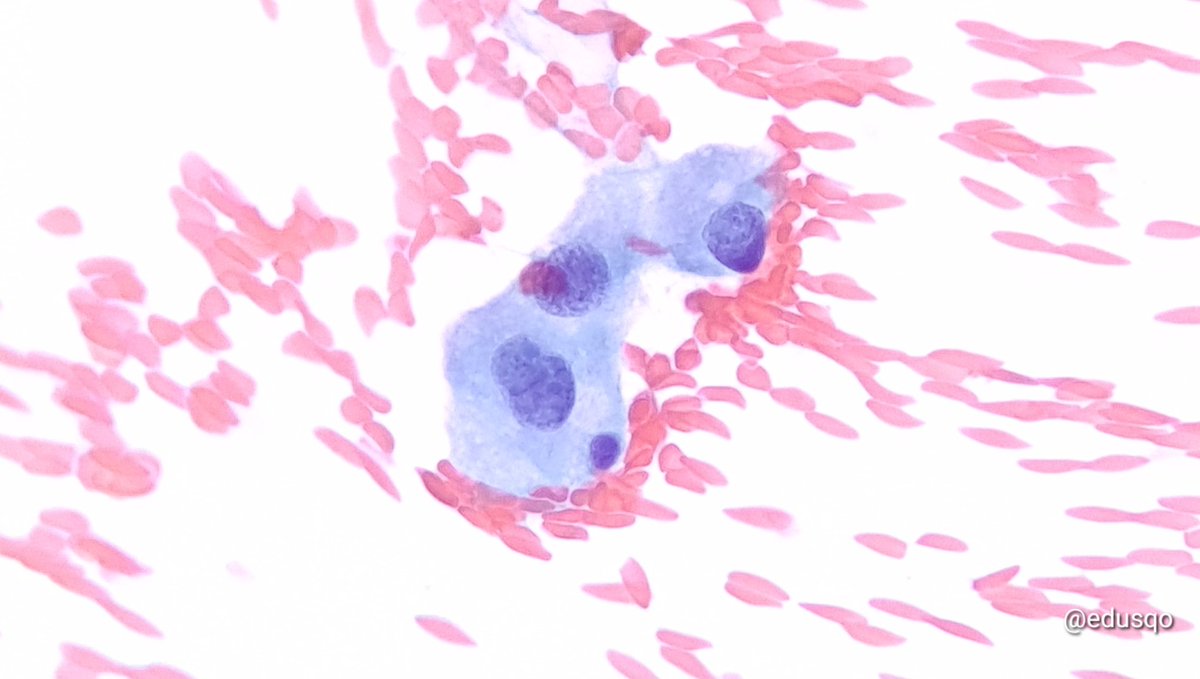 Eduardo Alcaraz, MD PhD tweet media