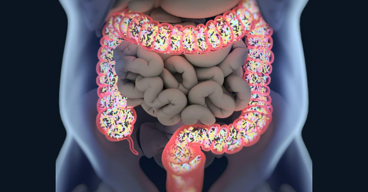 WebMD's tweet photo. Soybean oil, which is very common in processed foods, could drive conditions like inflammatory bowel disease and leaky gut. https://t.co/5XH8YqrW0b https://t.co/RY9NdcjJjE