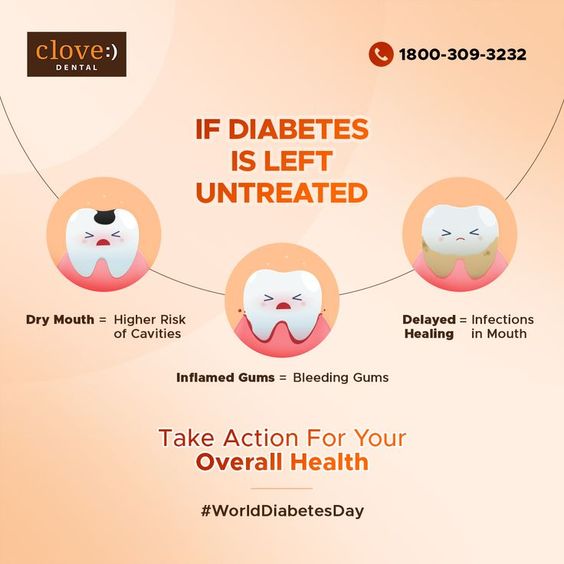 #Dentaltip Keep your blood sugar in check and do a regular dental check up.  #dentaltip #dentalcare #dentalhygiene #oralhygiene #dentalfun #oralcare #oralhealth #oralhygiene #dentist #vancouverdentists #dentalfact #diabetes #dentalfact