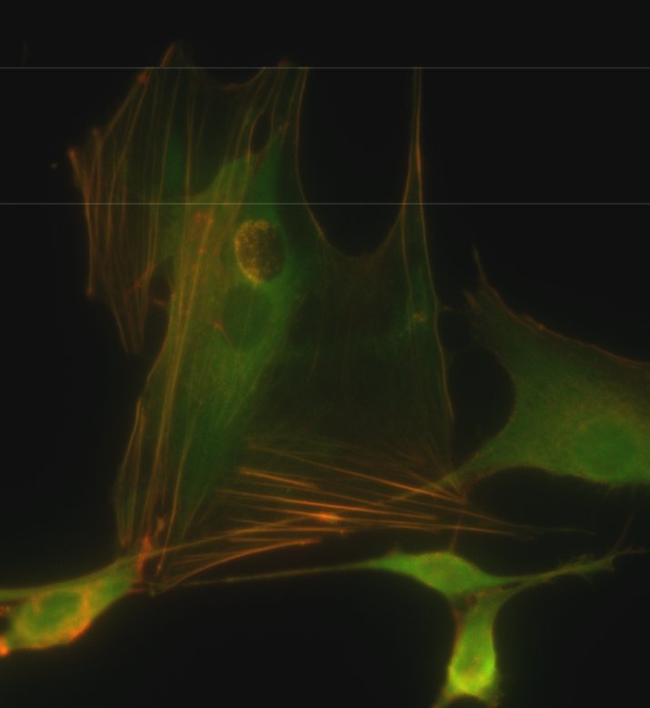 Back to basics this #fluorescencefriday with some angy fibroblasts. The classic phalloidin-red/aSMA-green