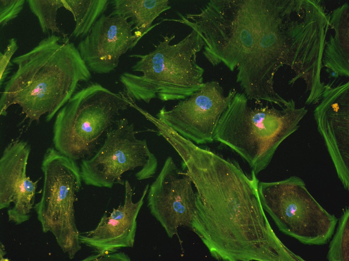 Happy Friday! Fetal intestinal cells brought you by Ziess Axio. Green-F-actin, pink-golgi apparatus (GOLPH2), orange B-actin.  #FluorescenceFriday #microscopy