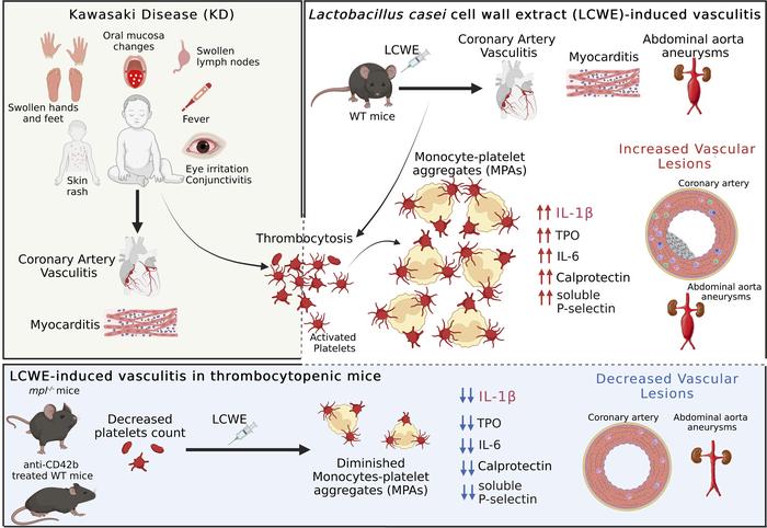 Platelets exacerbate cardiovascular inflammation in a murine model of Kawasaki disease vasculitis: buff.ly/3OOyV2F @ArditiMd @CedarsSinai #Inflammation #VascularBiology