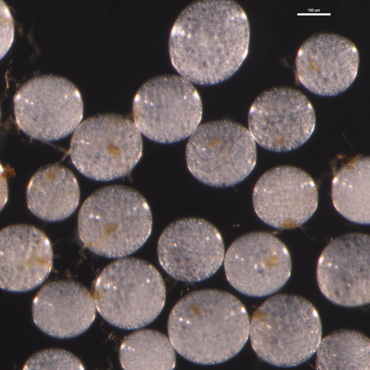 FungiInvam's tweet photo. Discover the magic of Cetraspora pellucida! Its resemblance to a crystal ball invites you to glimpse into the future – a captivating reminder that nature's wonders never cease to amaze! #AMF https://t.co/Rulb15PsKY https://t.co/729dVmES9g