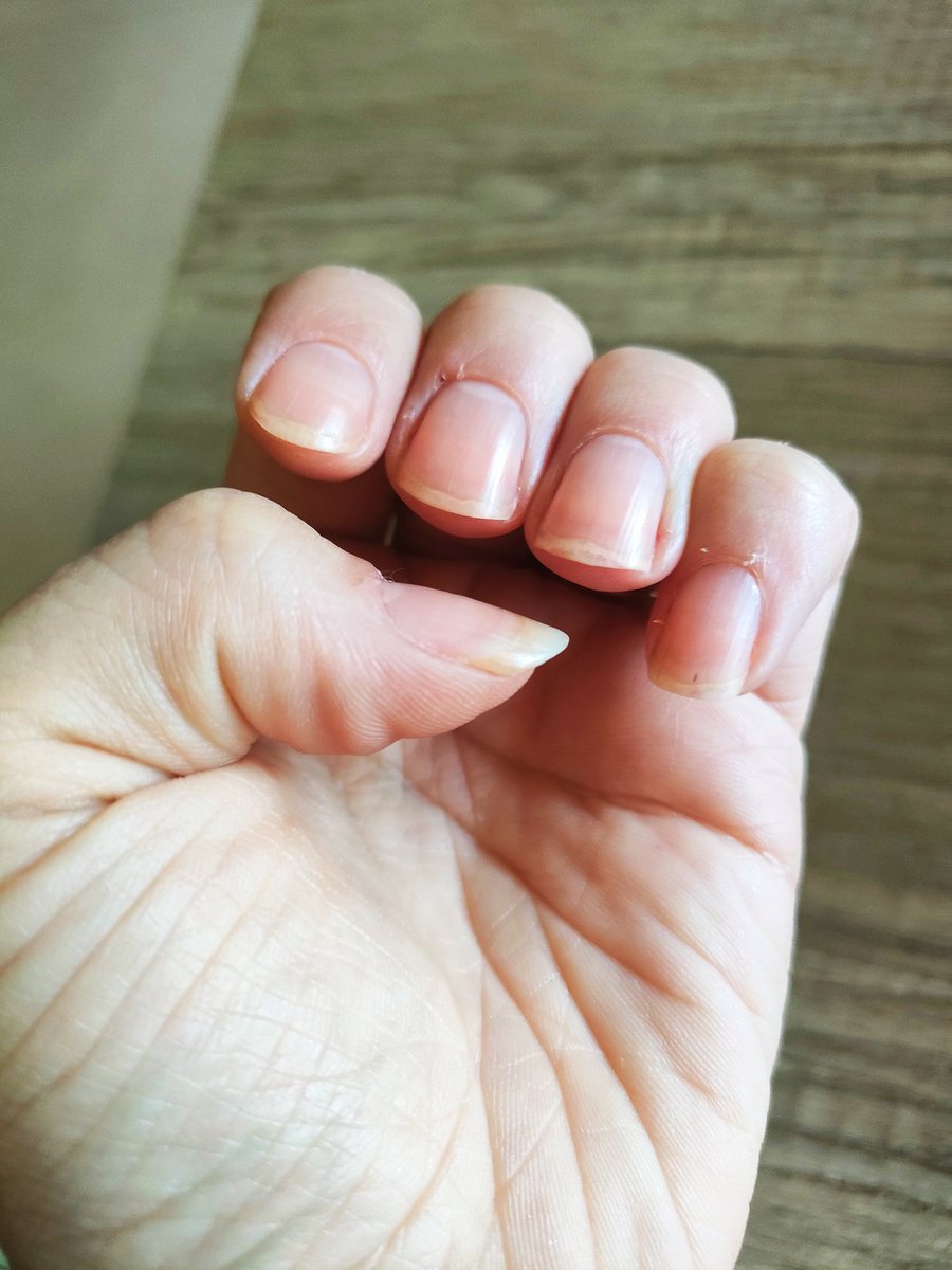 mmeechantillon's tweet image. Nouveau cadeau, merci @monvanityideal et #eyecarecosmetics  pour cette sélection, la #manucure est une passion donc bien contente de pouvoir tester ces vernis couleur pastel 🩵🩷de quoi sublimer mes ongles.

Je vous fais une photo AVANT puis APRÈS et rdv bientôt sur Youtube