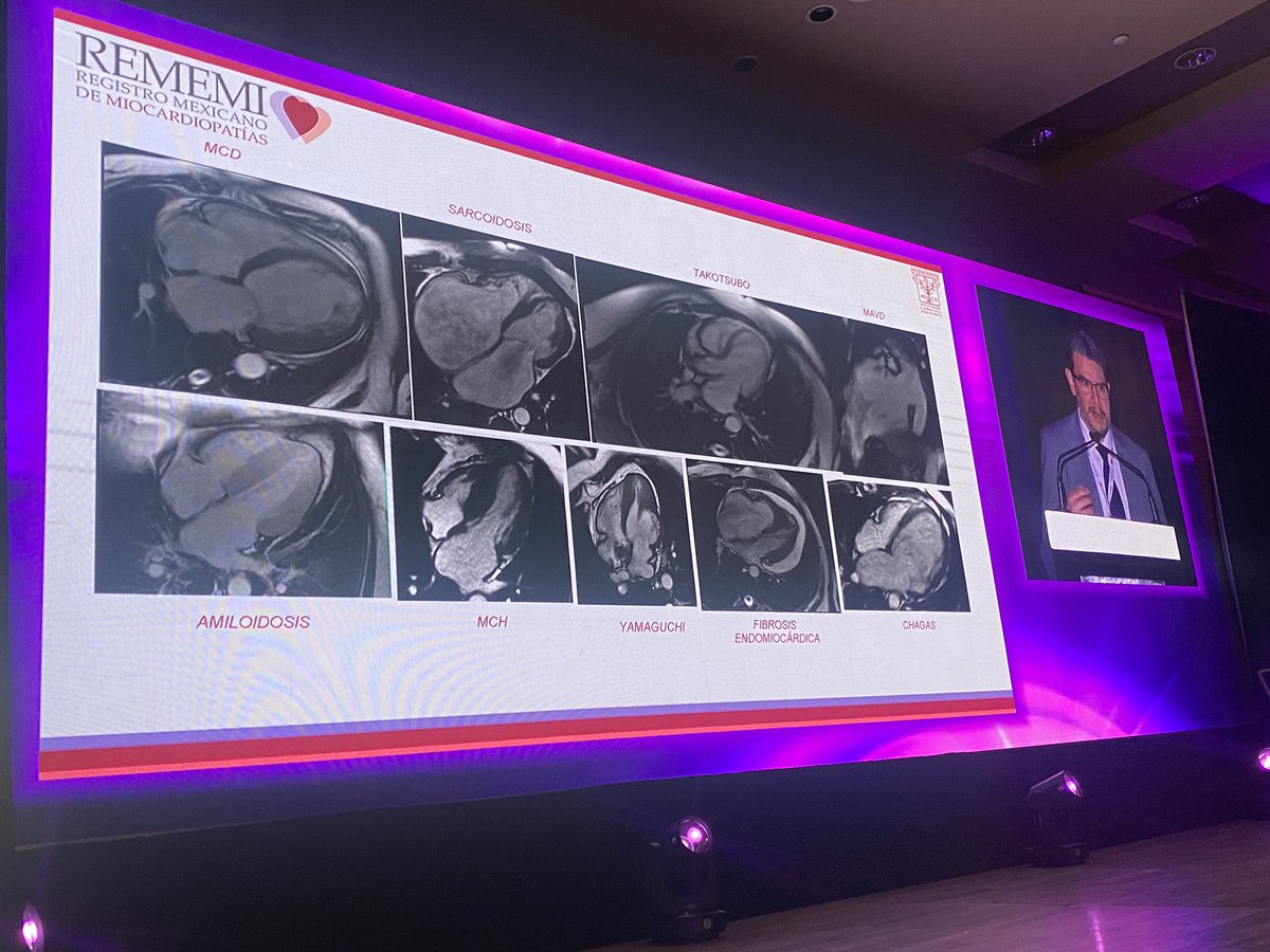 CardioAcademic's tweet photo. Simposium miocardiopatia hipertrofica. La utilidad de la resonancia magnética en miocardiopatias. Dr Guillermo Llamas, Dr Enrique Berriis #Cardioacademic23 https://t.co/qAwXjYPtmf