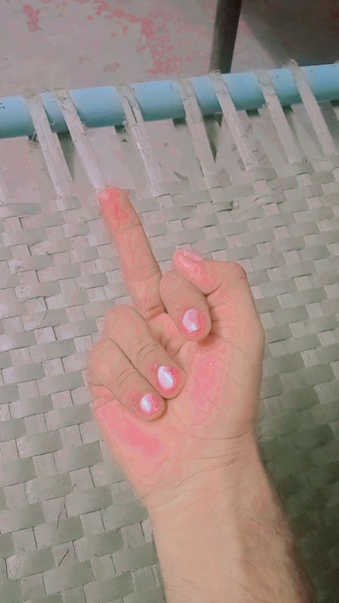 بے احتیاطی سے پھاڑی جانے والی چیزوں میں غبارےکا آج بھی دوسرے نمبر ہے