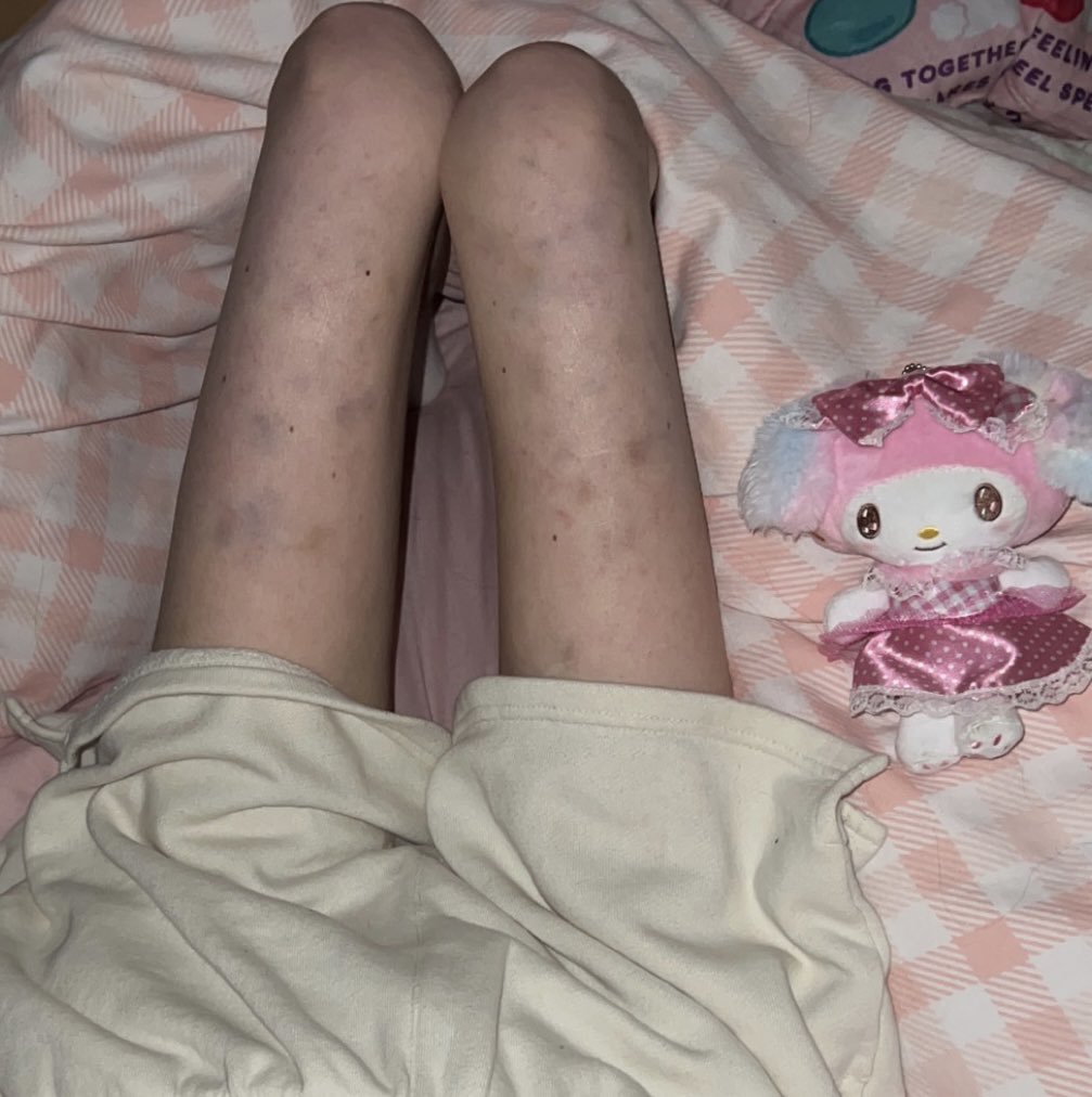dispiritedz's tweet photo. Legs body check ☆ https://t.co/rq1CrLAl0R