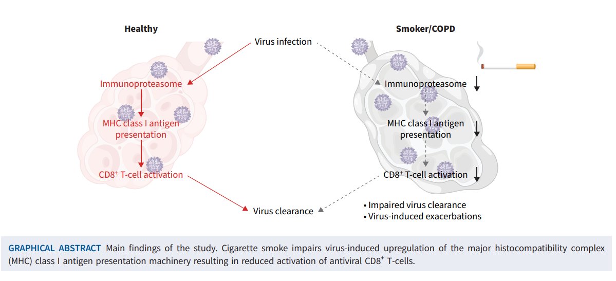 donsin4's tweet photo. Why do patients with #COPD get sick all the time with "flu-like" illness (i.e. #AECOPD)? Here is a reason why (i.e. impaired #adaptive #immunity) published in @ERSpublications . Could #PD1 inhibitors be the answer to reducing #AECOPD in #COPD? 
https://t.co/5DzCHNXLET https://t.co/y0gWNjUxBH