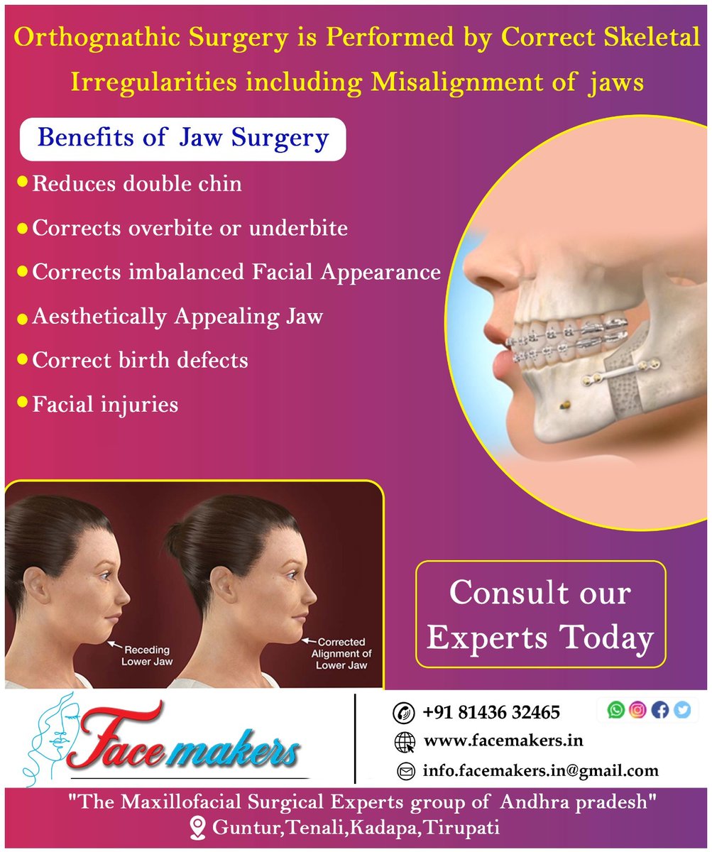 Benefits of Orthognathic Surgery
Contact :+91 81436 32465
#jawpain #jaw #jaws #brokenjaw #toothache #toothpain #accident #accidents #oralsurgeon #maxilla #dentalsurgery #dentalsurgeon
#orthognathicsurgery #bestmaxillofacialsurgeon #bestcosmeticsurgeon #birthdefects