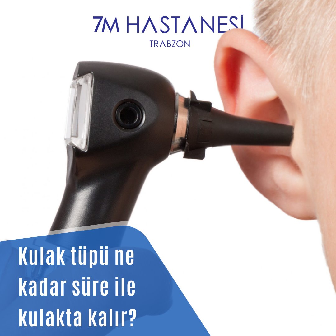 👂🏼 Kimlere kulak tüpü takılmalıdır?

🥼 OP. DR. BÜNYAMİN KUTLU - KULAK BURUN BOĞAZ HASTALIKLARI; sizler için cevaplıyor.

📍 Akçaabat / Trabzon
🌐 7mhastanesi.com.tr

#kulakağrısı #kulaktüpü #kulakestetiği #grip #trabzonestetik #estetiktrabzon