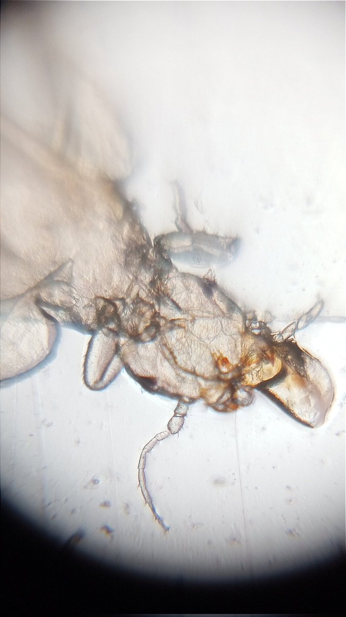 Dinesh9145's tweet image. Discovered with the #Foldscope: Acari (mites) and lice found in spoiled dry grapes. 🍇🔍 These tiny creatures enjoy the moist environment of spoiled fruits. Remember to dispose of affected grapes to avoid further infestation. #Microscopy #NatureDiscovery 🐜🍇