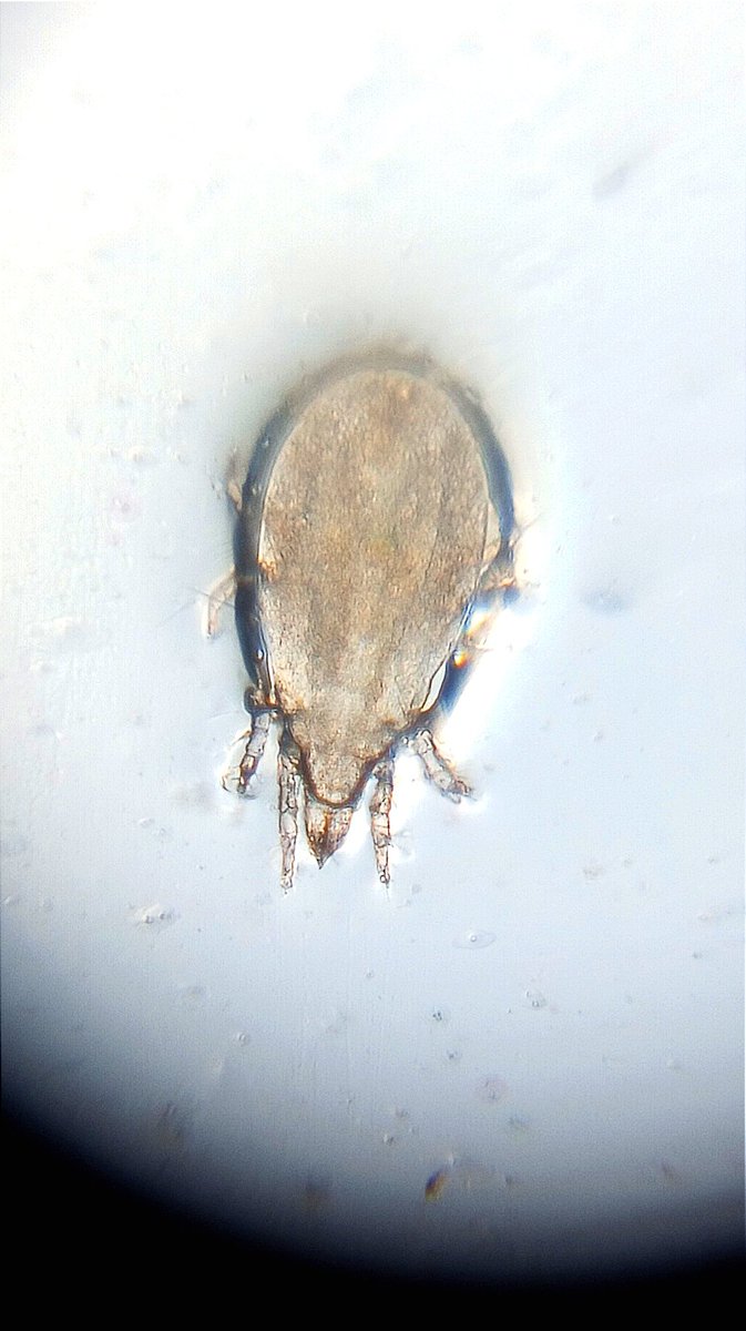 Dinesh9145's tweet image. Discovered with the #Foldscope: Acari (mites) and lice found in spoiled dry grapes. 🍇🔍 These tiny creatures enjoy the moist environment of spoiled fruits. Remember to dispose of affected grapes to avoid further infestation. #Microscopy #NatureDiscovery 🐜🍇