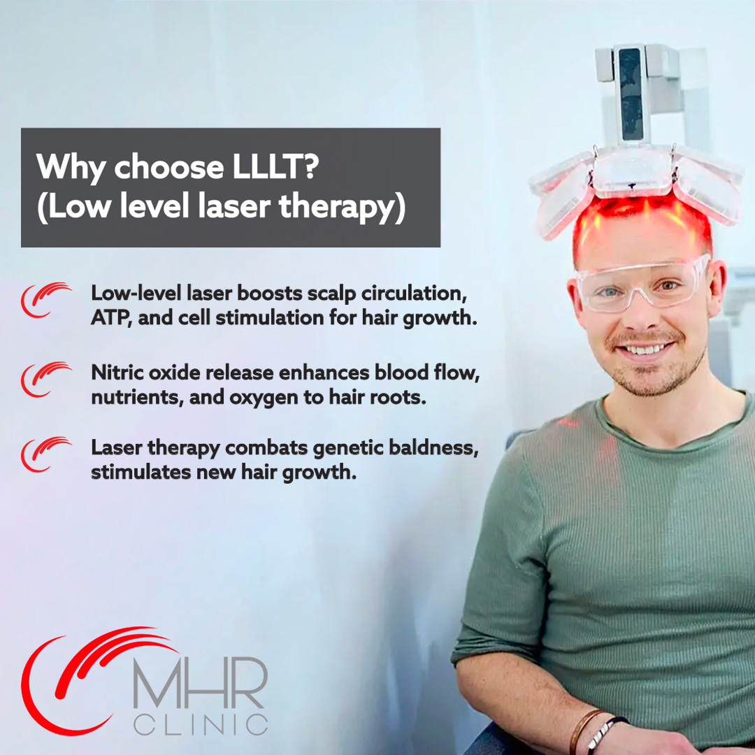 MHRClinicUK's tweet photo. Our advanced low-level laser therapy stimulates blood flow, energises follicles, and promotes healthy hair growth.

Say goodbye to hair loss worries as we tackle genetic patterns with cutting-edge techniques. Reclaim your confidence today! 👱

#HairLossAwareness #BaldingSolutions https://t.co/gYggRrVGyc