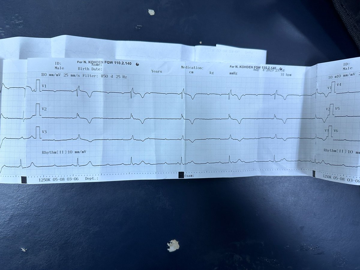 dr_hsynbsr's tweet photo. Merak edene ekg si https://t.co/TukiPfI95E