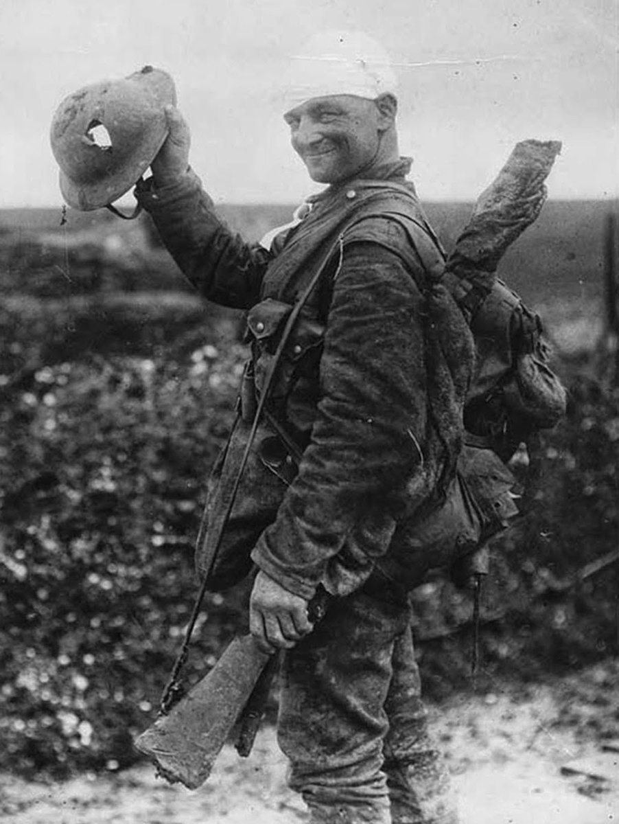 A lucky WW1 British soldier shows off the helmet that saved his life. Although clearly wounded, the shrapnel that tore the hole in the helmet would have almost certainly killed the man had he been unprotected.

During the first world war, shrapnel from exploding artillery shells