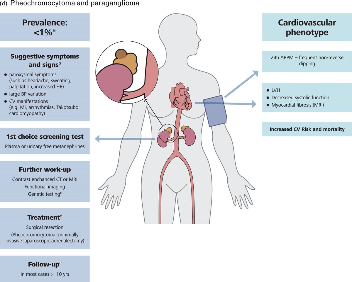 imedverse's tweet photo. 2023 ESH Guidelines for the management of arterial hypertension The Task Force for the management of arterial hypertension of the European Society of Hypertension Endorsed by the European Renal Association (ERA) and the International Society of Hypertension (ISH) @ESHypertension https://t.co/APG9amqUdR