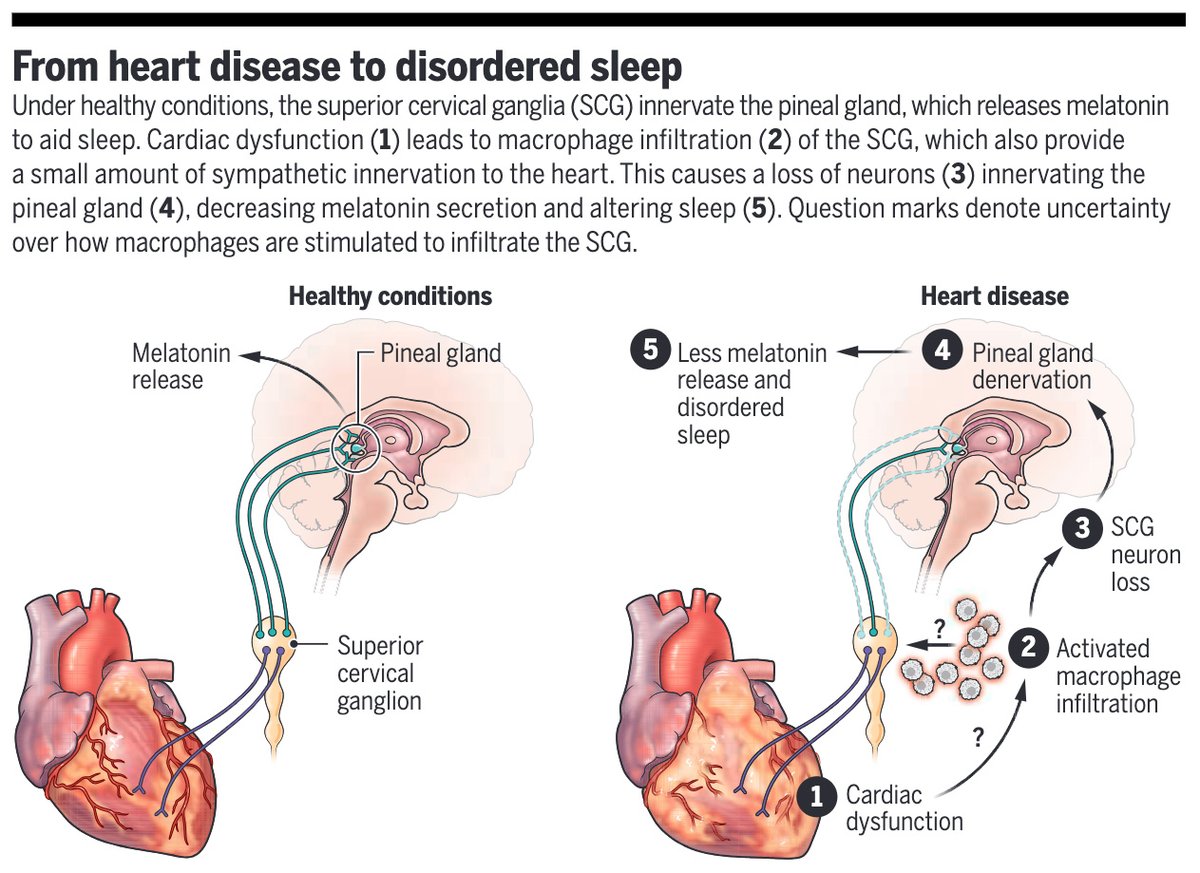 New research describes a pathway by which cardiac disease leads to immune-mediated sympathetic denervation of the pineal gland and a subsequent decrease in circulating melatonin, causing sleep disruption. 📄: scim.ag/3Ck #SciencePerspective: scim.ag/3Cl