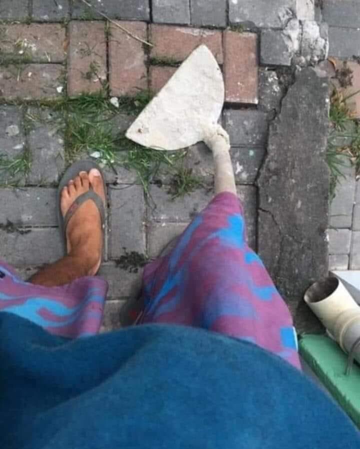 hoje eu acordei com a perna inchadakkkkkk
