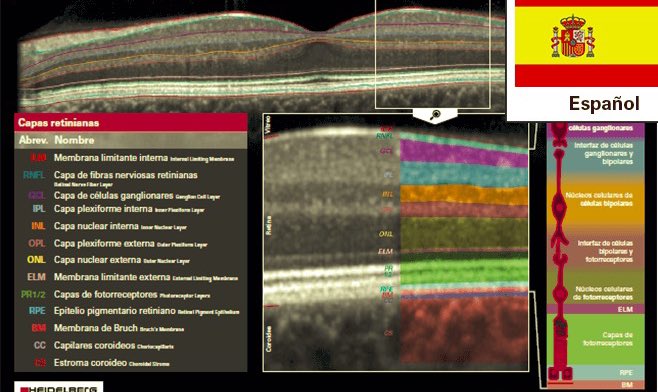 DrHectorMSolano's tweet photo. Correlación Anatómica de las capas de la retina mediante OCT https://t.co/eHyCNRFdxJ