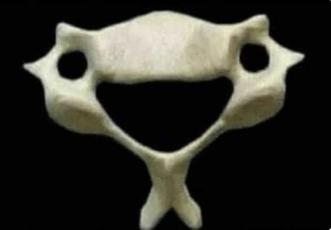 Oren Gottfried, MD (@ogdukeneurosurg) on Twitter photo If you’re feeling down, remember this C6 vertebra and how happy it is to hold you (and your head) up every day. <a href="/EnsedeCiencia/">Enséñame de Ciencia</a> If you’re feeling down, remember this C6 vertebra and how happy it is to hold you (and your head) up every day. <a href="/EnsedeCiencia/">Enséñame de Ciencia</a>