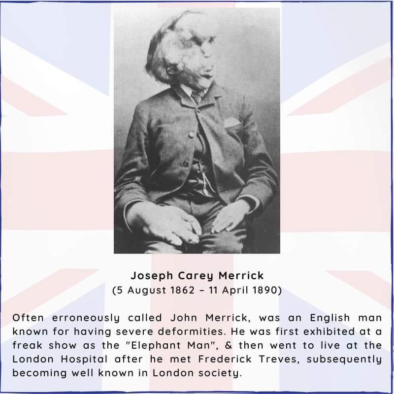 BritishHistorym's tweet photo. #otd 5 August 1862 – Joseph Merrick, English man with severe deformities was born (d. 1890)
#JosephMerrick #Britishhistory #History #onthisdayinhistory #Fredericktreves #QueenAlexandra https://t.co/fgJ3FGl2Gk