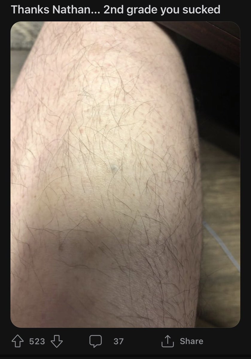 lilgrapefruits's tweet photo. just discovered the reddit support group for people who were stabbed with a pencil as a child https://t.co/DIznSt9V7G