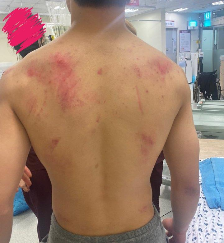 korea_gookmin's tweet photo. 오늘저녁 의정부시 금오동 칼부림 관련 오보 피해자 입니다 https://t.co/FWcE7XyL6L 

경찰청장이 경고 없이 권총·테이저건 주저 않고 쏜다더니 진짜 생사람 잡겠다.... https://t.co/143FLQLyGV