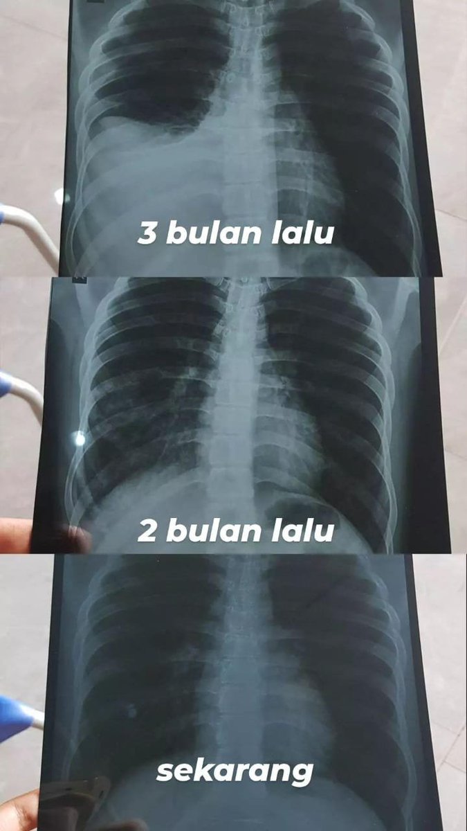 pikri tweet media
