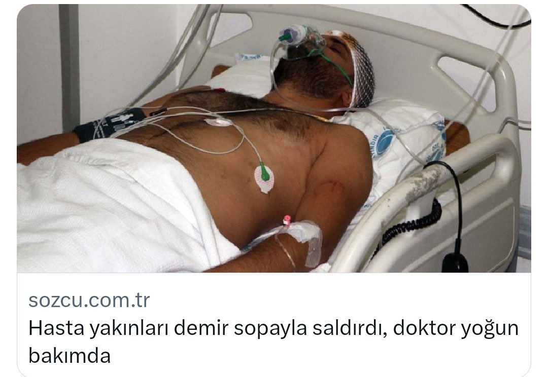 Gaziantep’te özel bir hastanede çocuğuna damar yolu açılamadığı gerekçesi ile olay çıkartıp, 20 kişi ile hastaneyi basıp terör estirdiler! Ve hala yetkililerden bir açıklama gelmedi…
 #hekimlikyoğunbakımda