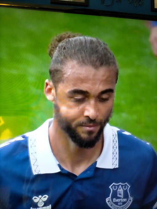 Booing Dom like it's his fault his cheek is the size of a golf ball or like he wants to be injured.

One week banging on about mental health and how were all with Dele.

Now this week booing a player who wants to play off because he's injured. 
#AVLEVE #calvertlewin #Pickford