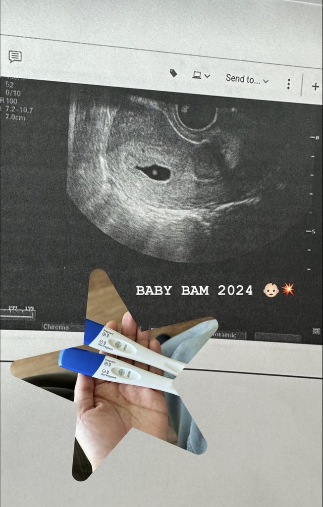 GarciaBoxing's tweet photo. Congrats Champ! Baby Bam has already signed a lifetime contract with RGBA 💪 @210bam https://t.co/k7hZVjqWu8