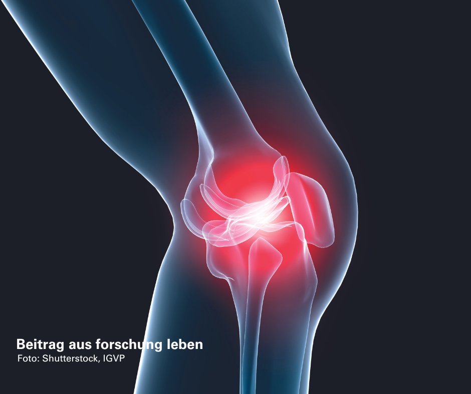 Uni_Stuttgart's tweet image. Forschende der #UniStuttgart &amp;amp; des Fraunhofer-Institut für Grenzflächen- &amp;amp; Bioverfahrenstechnik erforschen, wie Schäden an Gelenkknorpeln repariert werden können. Personalisierte, biomimetische Knorpelimplantate könnten dabei im #3DDrucker entstehen 👉 bit.ly/3DZKm19