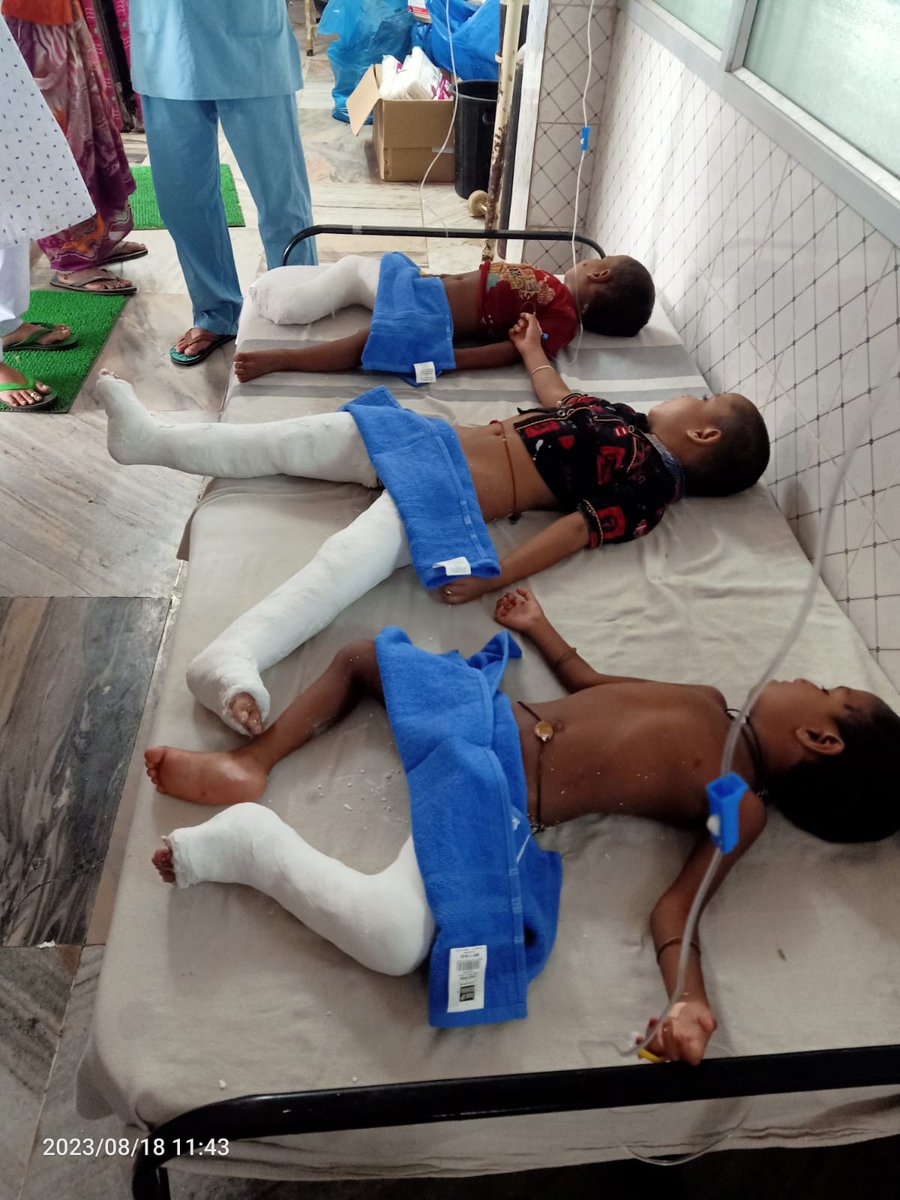 ଜିଲ୍ଲା ମୁଖ୍ୟ ଚିକିତ୍ସାଳୟରେ ଜନ୍ମଗତ ପାଦ ବିକୃତି ଅସ୍ତ୍ରୋପଚାର ଶିବିର ଆଜି ଜିଲ୍ଲାପାଳ,ଭଦ୍ରକଙ୍କ ଉପସ୍ଥିତ ରେ ଅନୁଷ୍ଠିତ ହୋଇଯାଇଛି।ଏହି ଶିବିରରେ ପିଲାମାନଙ୍କର ଜନ୍ମଗତ ପାଦ ବିକୃତି ର ଅସ୍ତ୍ରୋପଚାର କରାଯାଇଛି।ଏହା ଆସନ୍ତା ୯ ସେପ୍ଟେମ୍ବର ୨୦୨୩ ପର୍ଯ୍ୟନ୍ତ ଚାଲିବ।