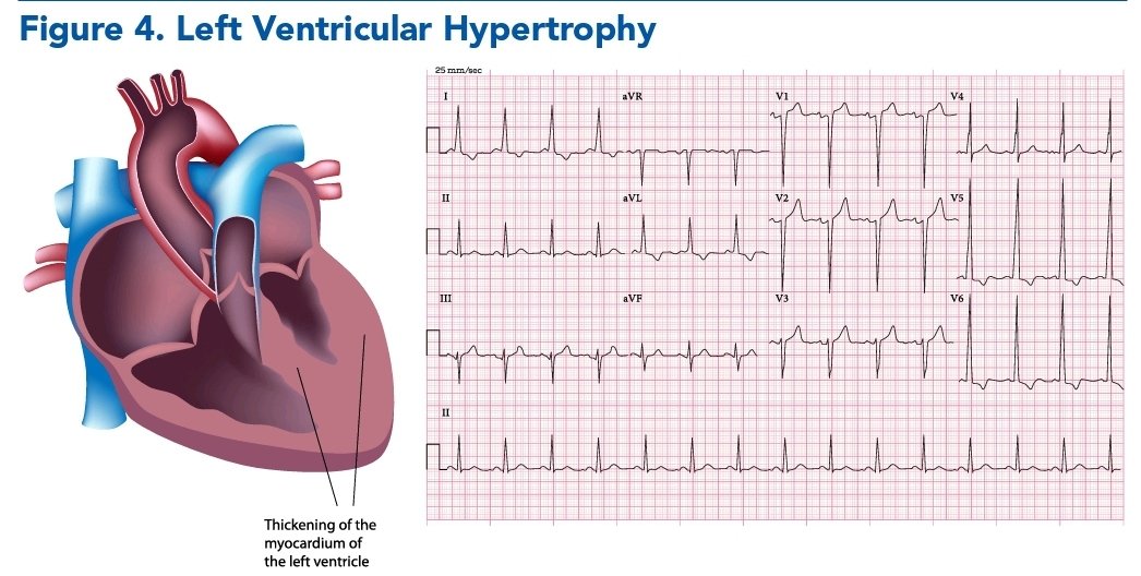 LeslieMegom's tweet photo. 🏥🚨Urgencias hipertensivas🫀💥: Directrices y recomendaciones 📚👩‍⚕️🚨👨🏻‍⚕️Algoritmo de intervención.
👇👇👇👇👇👇
https://t.co/NiBWBFEYLL
🗝🔓
https://t.co/qUImdcCddQ https://t.co/ig3ttgQmUc