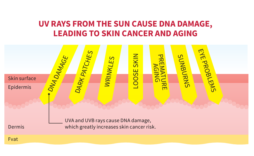 August is #SummerSunSafetyMonth! DYK that the sun's UV rays can damage your skin, leading to wrinkles/premature aging, sunburns, eye problems and more? Check out the full infographic on how to prevent skin cancer: cancer.org/content/dam/ca…