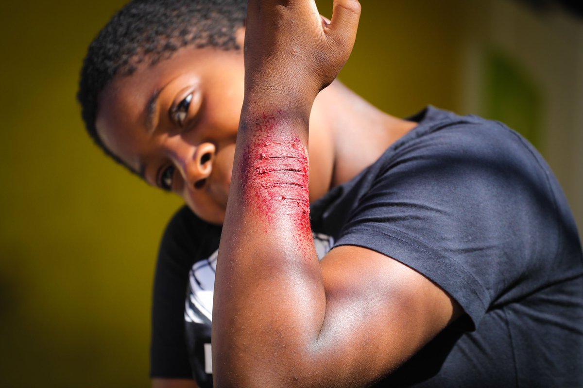 WHYCNunhead's tweet photo. #youngvolunteer Faith excelled herself yesterday with her #SpecialEffects make up! @LondonYouth #CVC #RDAS #youthwork A few shocked parents/carers at home time! Pics by @Quincunxxx https://t.co/HGk8rPtMC7
