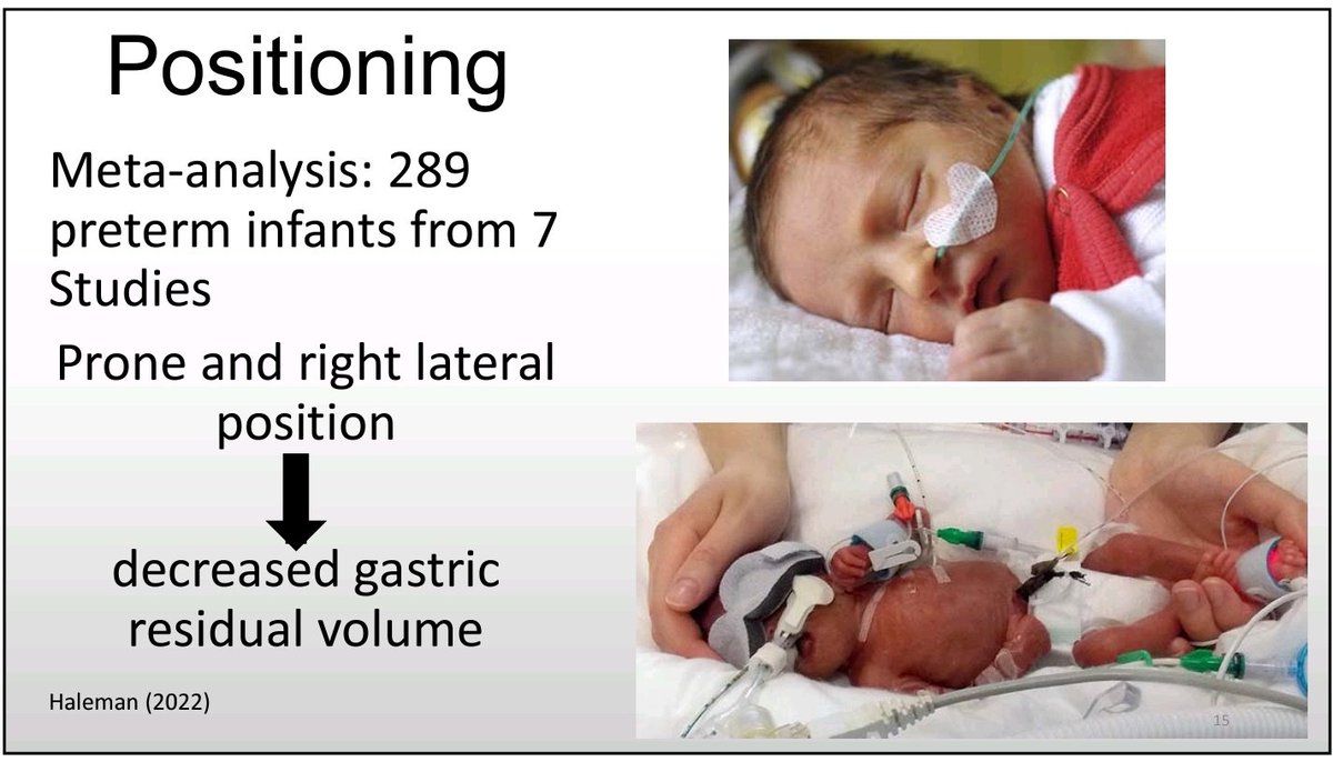 #OccupationalTherapy at NICU