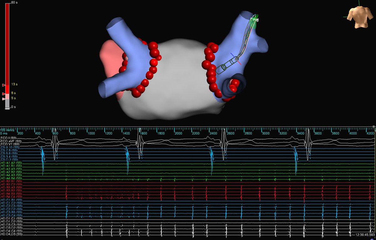 It never gets old seeing this proof of concept <a href="/AbbottCardio/">Abbott Cardiovascular</a>
