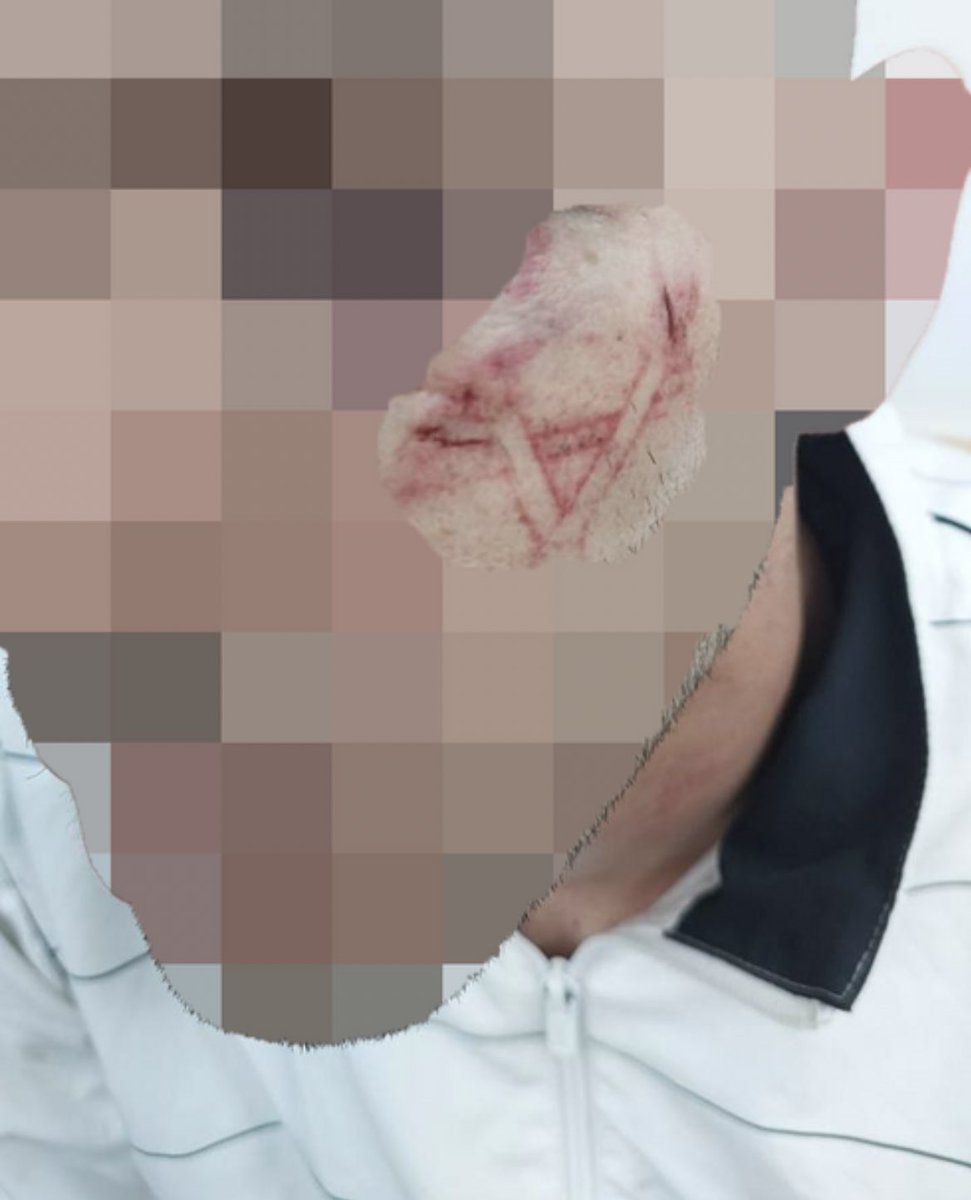 Israeli Policemen beat up a Palestinian resident of Shuafat refugee camp, covered his face, tied him up, punched him and seard a Star of David on his face. 16 police officers with 16 body cams- all malfunctioned. One Palestinian with a tattooed Star of David. 

I feel sick