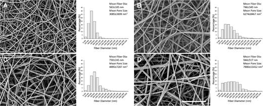 TVST Journal (@arvotvst) on Twitter photo Jessica M. Gluck et al. <a href="/gluck_lab/">Gluck Tissue Engineering Laboratory</a> <a href="/NCStateWilson/">Wilson College of Textiles</a> develop and characterize electrospun corneal bandage infused with Noggin protein and evaluate its therapeutic potential in the treatment of superficial nonhealing corneal ulceration.
doi.org/10.1167/tvst.1โฆ Jessica M. Gluck et al. <a href="/gluck_lab/">Gluck Tissue Engineering Laboratory</a> <a href="/NCStateWilson/">Wilson College of Textiles</a> develop and characterize electrospun corneal bandage infused with Noggin protein and evaluate its therapeutic potential in the treatment of superficial nonhealing corneal ulceration.
doi.org/10.1167/tvst.1โฆ