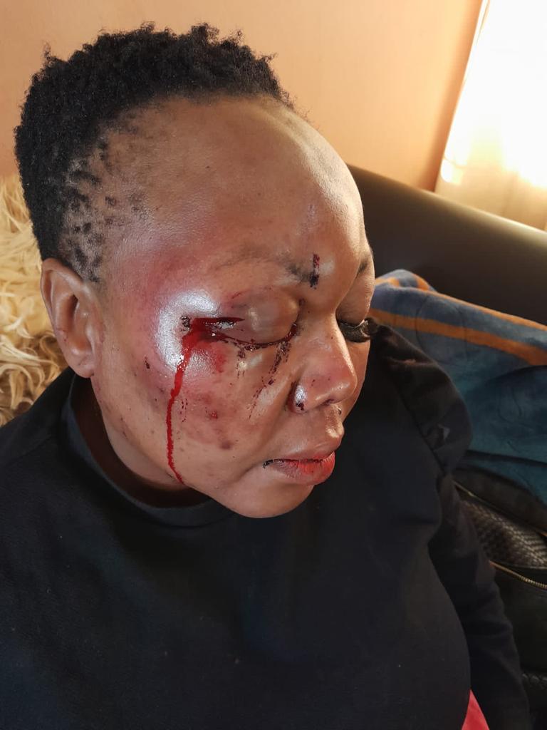 The entire family in Soweto was attacked by 4 ZEP holding Zimbabweans. She was almost raped and was saved by lying that she just recently had a miscarriage. Everything happened right in front of her partner and 3 sons 17,10 and 7.