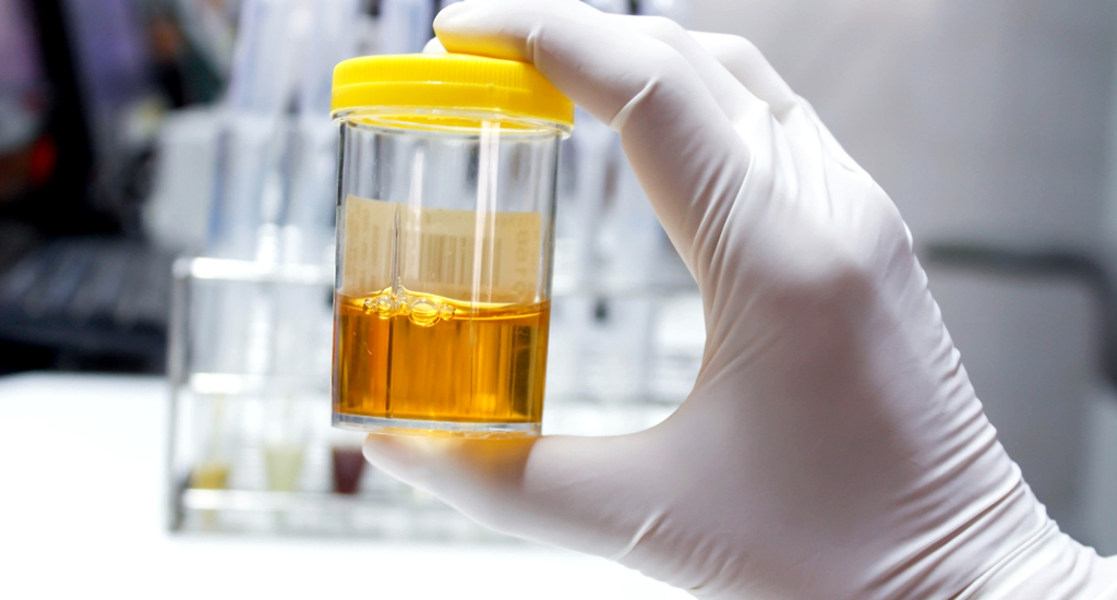 Pressão de vapor: conheça a análise através do Method Reid.
texasoiltech.com.br/pressao-de-vap…
#Combustivel #Combustiveis #Petroleo #Lubrificante #Lubrificantes #Graxa #Fluido #Fluidos #GasNatural #AnaliseLaboratorial #AnaliseQuimica #TexasOilTech #TOLBR