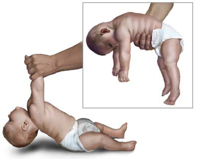 recentadvances's tweet photo. Floppy baby syndrome refers to an infant’s #flabby muscles. This symptom complex might mask a variety of illnesses, ranging from benign congenital #hypotonia to Down syndrome and Werdnig-Hoffmann disease.

Read further👉https://t.co/MiN0HMKUUi

#floppybaby https://t.co/x8zdzzJVEl